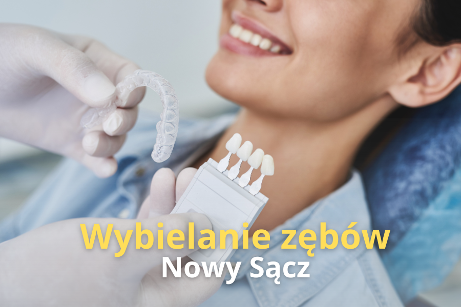 Metody wybielania zębów u dentysty Wybielanie zębów w gabinecie stomatologicznym