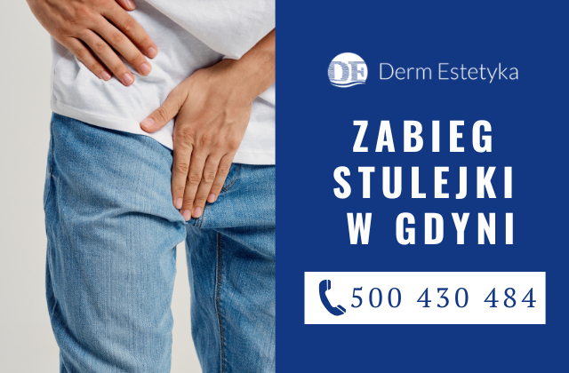 Zabieg stulejki w klinice Derm-Estetyka w Gdyni